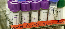 В Молдове за минувший день число заболевших «свиным» гриппом выросло в 1,7 раза